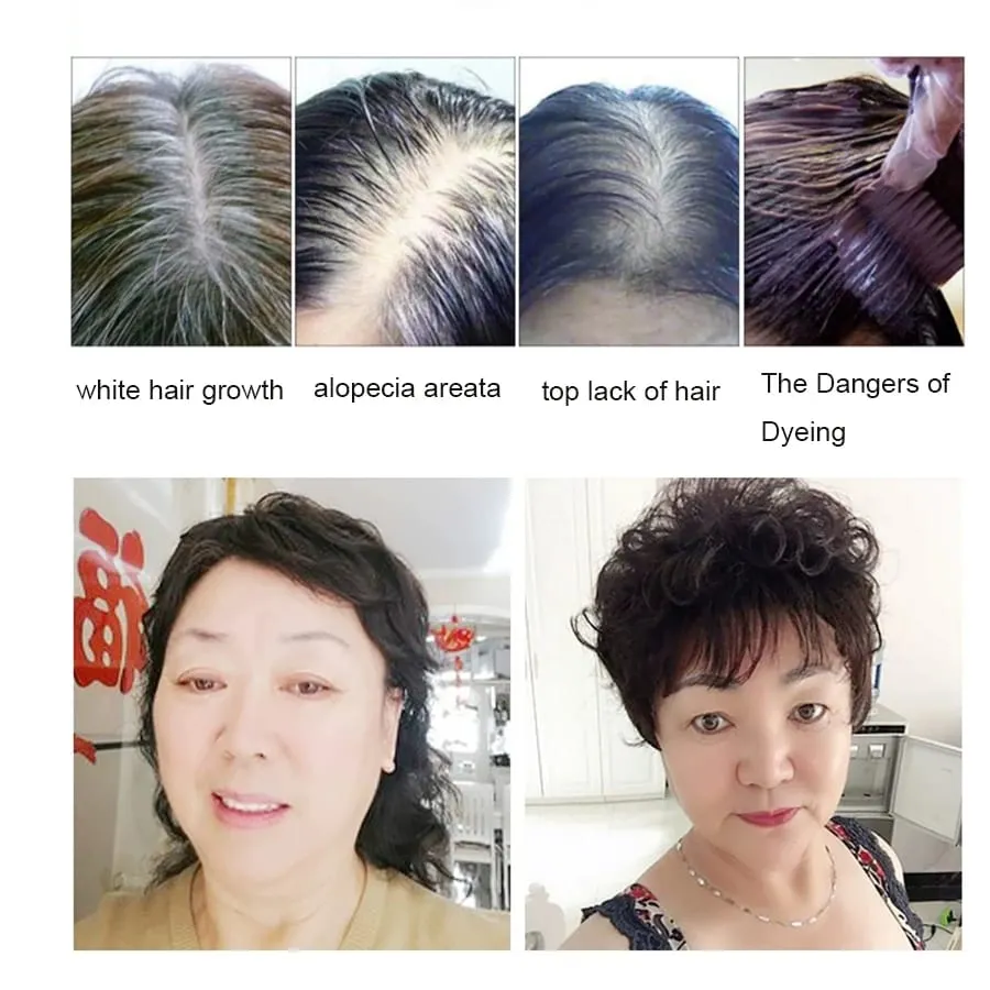 Bangs 3D Air Hair Bangs Edge κομμένο σε κτυπήματα Extended Hair Piece Bangs Περούκα Κόψτε επάνω Τριχόπτωση για να καλύψει τα γκρίζα μαλλιά Αύξηση όγκου — image 4